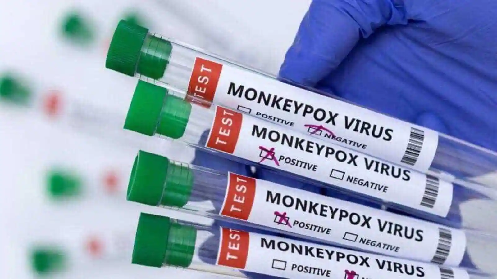 bforblogs Monkeypox in India: Delhi-based man found positive, Total case counts 04 Now