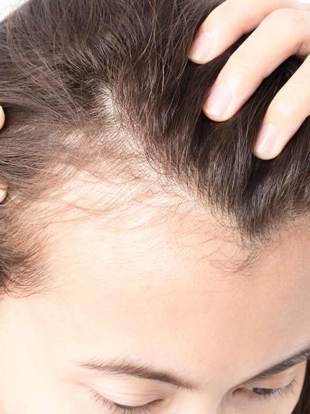 Say Goodbye to Bald Spots: Tips & Techniques